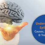 Neurologist in Hyderabad