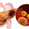 Best Gastroenterologist in Hyderabad