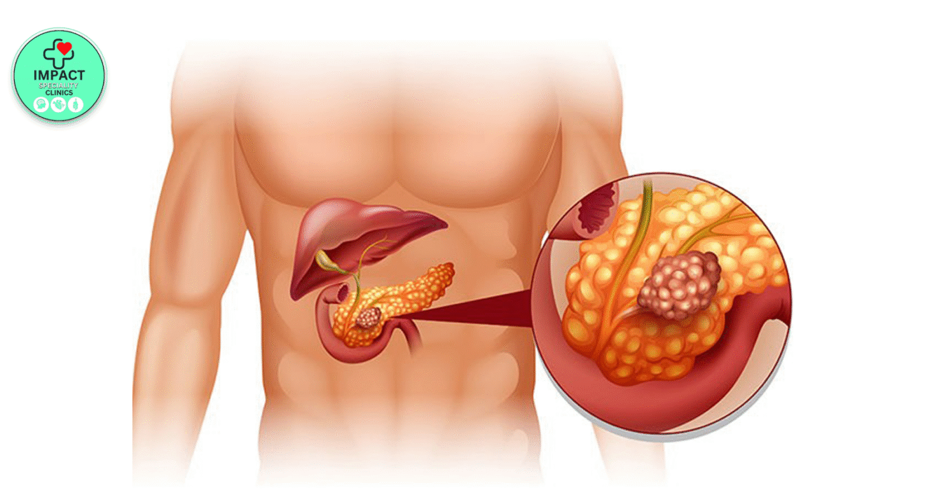 Pancreas Specialist in Hyderabad